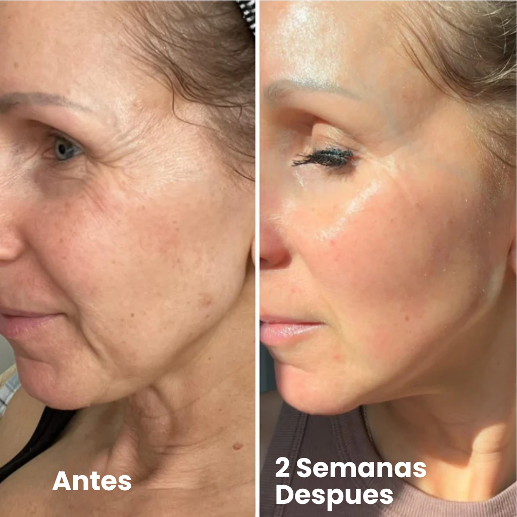 Fiorea® Retinal Shot - Adiós Arrugas