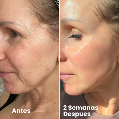 Fiorea® Retinal Shot - Adiós Arrugas